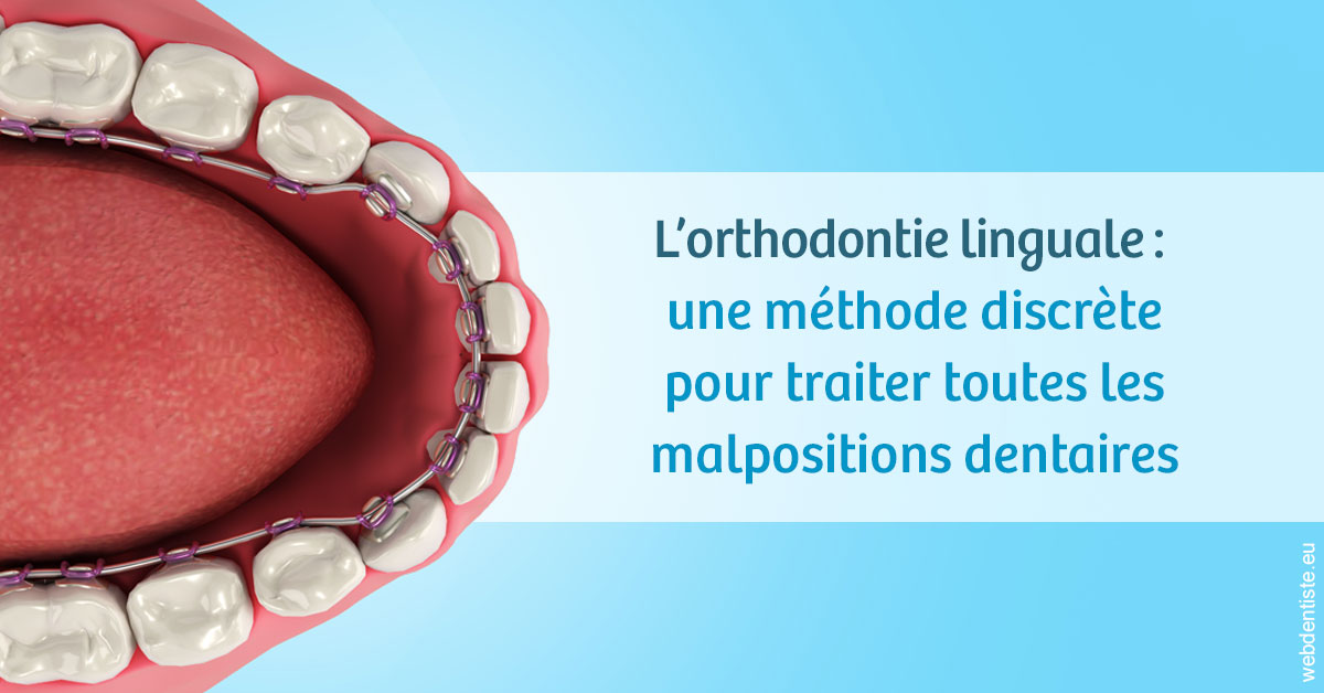 https://dr-halb-luc-joseph.chirurgiens-dentistes.fr/L'orthodontie linguale 1