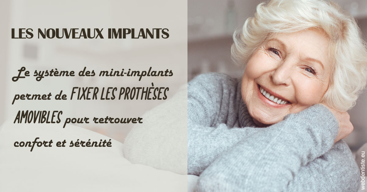 https://dr-halb-luc-joseph.chirurgiens-dentistes.fr/Les nouveaux implants 1