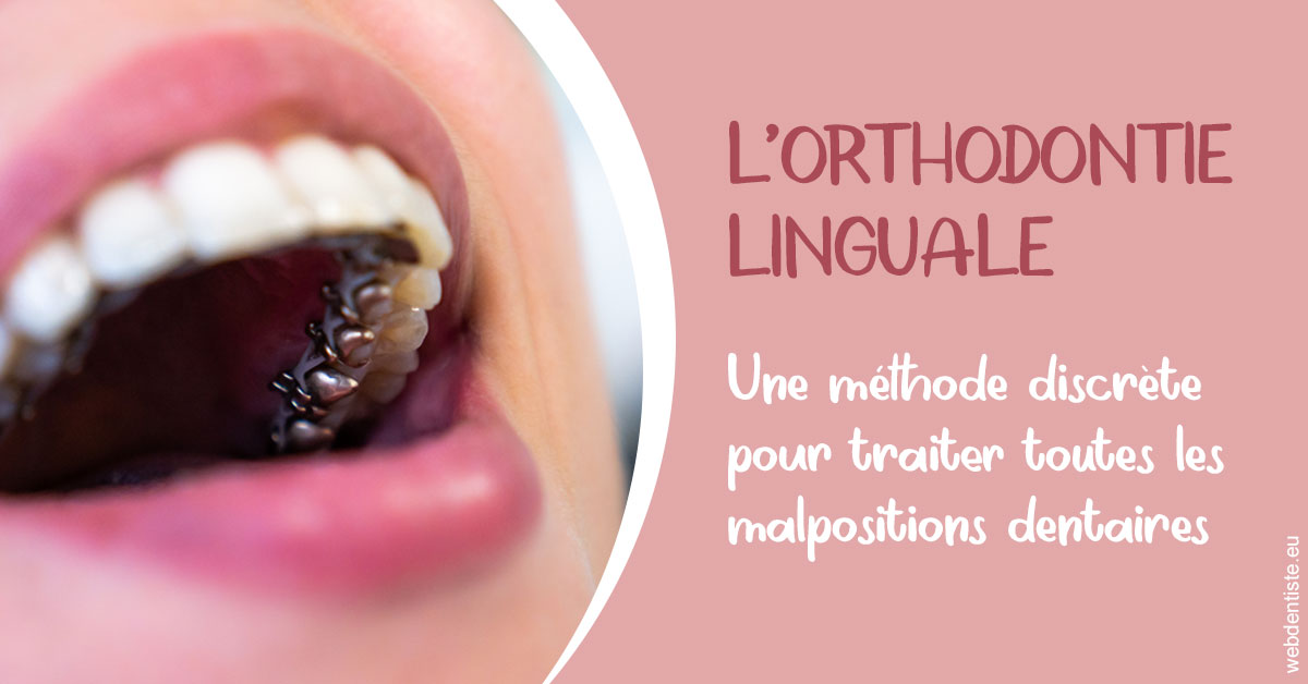 https://dr-halb-luc-joseph.chirurgiens-dentistes.fr/L'orthodontie linguale 2