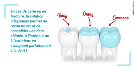https://dr-halb-luc-joseph.chirurgiens-dentistes.fr/L'INLAY ou l'ONLAY