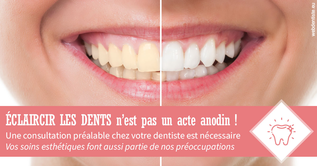 https://dr-halb-luc-joseph.chirurgiens-dentistes.fr/Eclaircir les dents 1