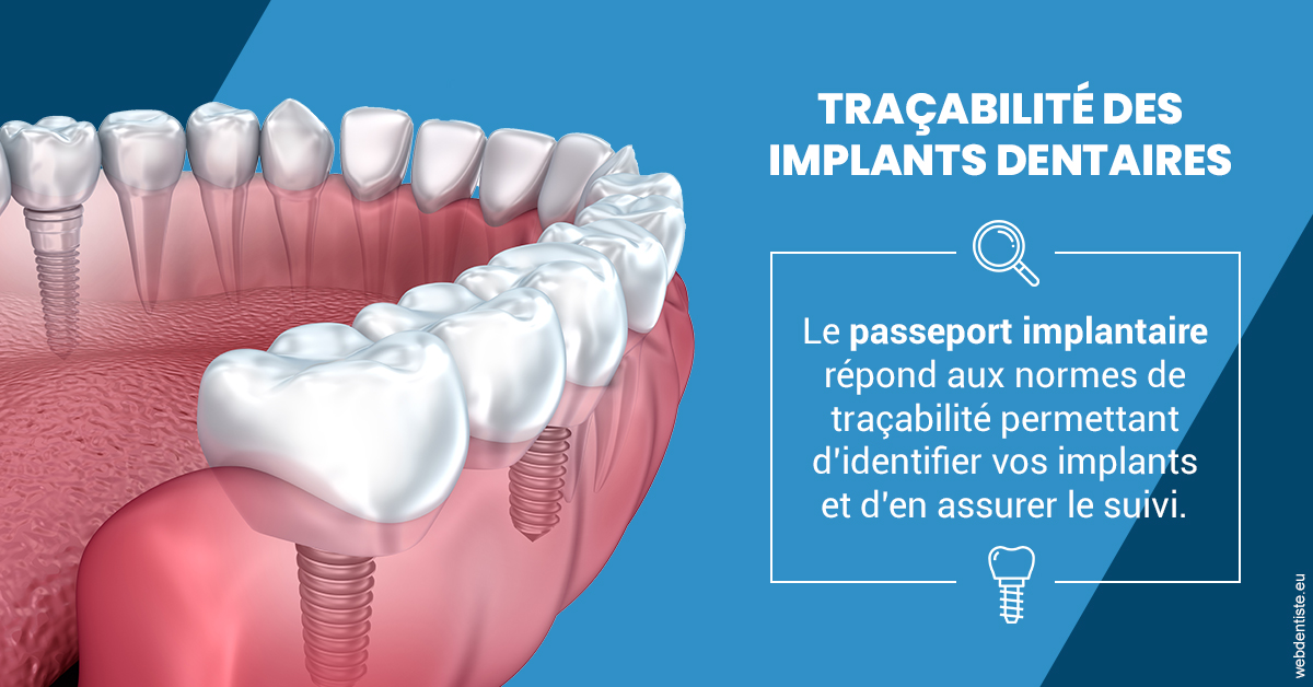 https://dr-halb-luc-joseph.chirurgiens-dentistes.fr/T2 2023 - Traçabilité des implants 1