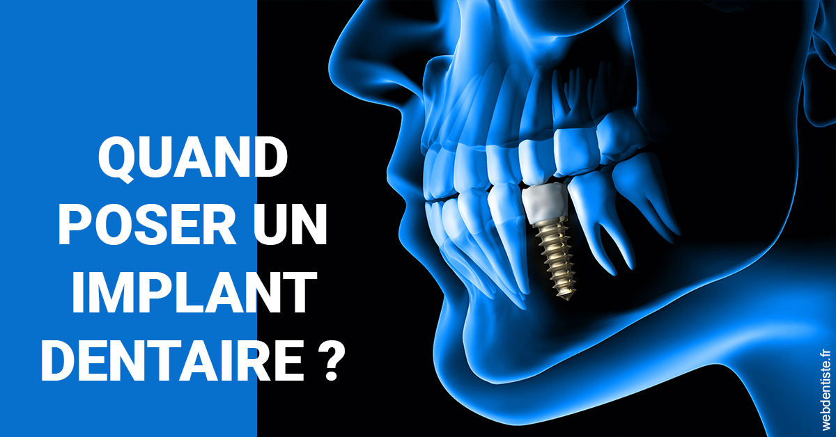 https://dr-halb-luc-joseph.chirurgiens-dentistes.fr/Les implants 1