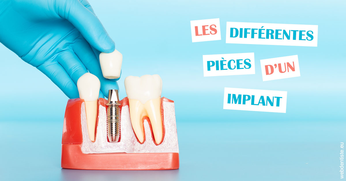 https://dr-halb-luc-joseph.chirurgiens-dentistes.fr/Les différentes pièces d’un implant 2