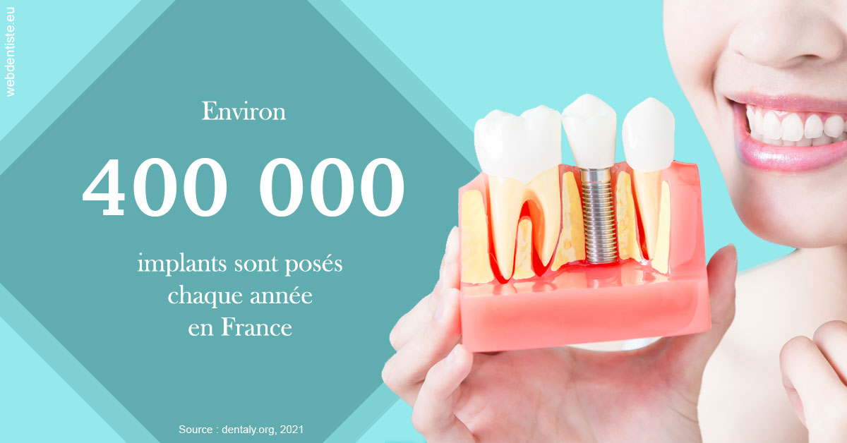 https://dr-halb-luc-joseph.chirurgiens-dentistes.fr/Pose d'implants en France 2