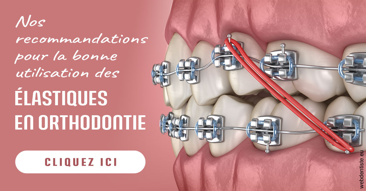 https://dr-halb-luc-joseph.chirurgiens-dentistes.fr/Elastiques orthodontie 2